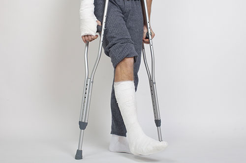 交通事故で骨折した場合の慰謝料はいくら？