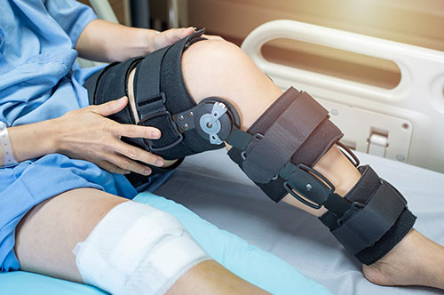 膝の靱帯損傷をした場合の後遺障害等級は？ 申請方法や認定のポ...