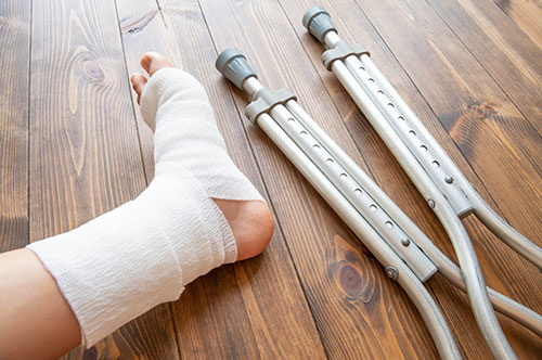 交通事故で骨折！ 慰謝料請求や給付補償などについて