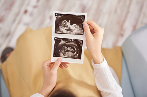 堕胎罪の定義とは？ 暴力や事故で中絶した場合はどうなるのか